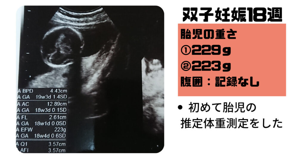 【双子妊娠5ヵ月（16週～19週）】18週の健診で初めて双子の体重測定
